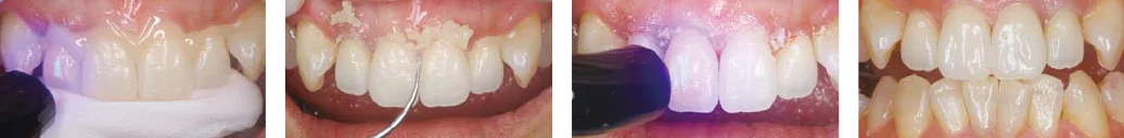 使用方法 Step4-7